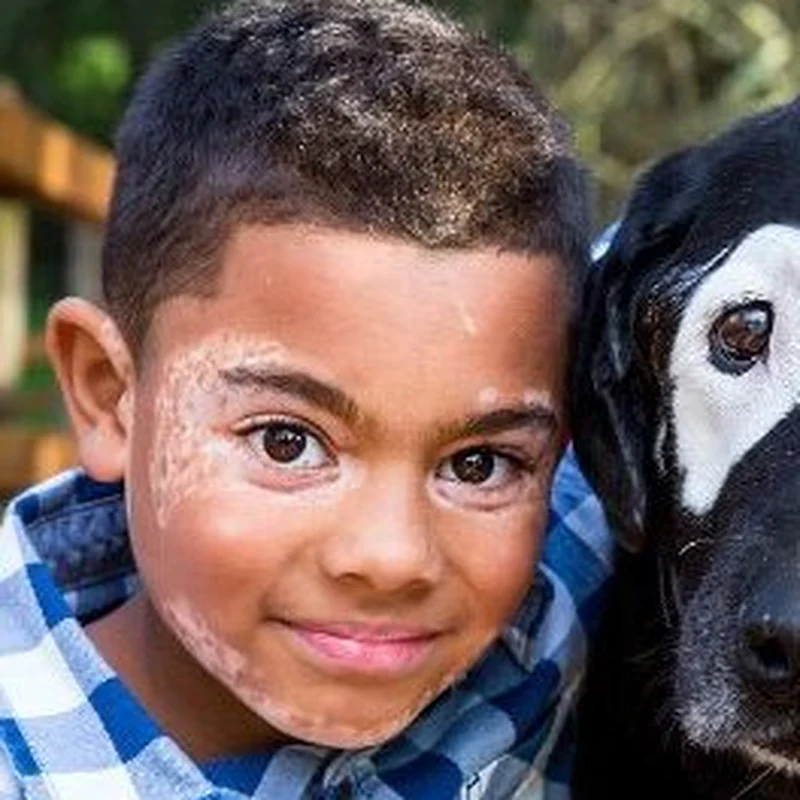 Close crop of Carter's face showing his vitiligo markings beside part of Rowdy's face