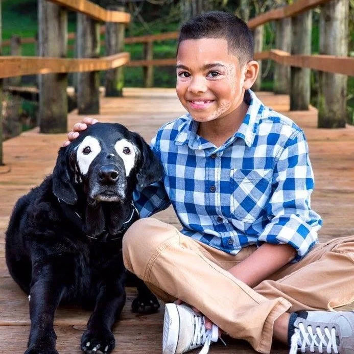 Carter sitting beside Rowdy, both showing white vitiligo markings around their eyes